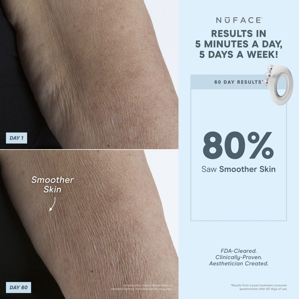 NuBODY® - Body Toning Device