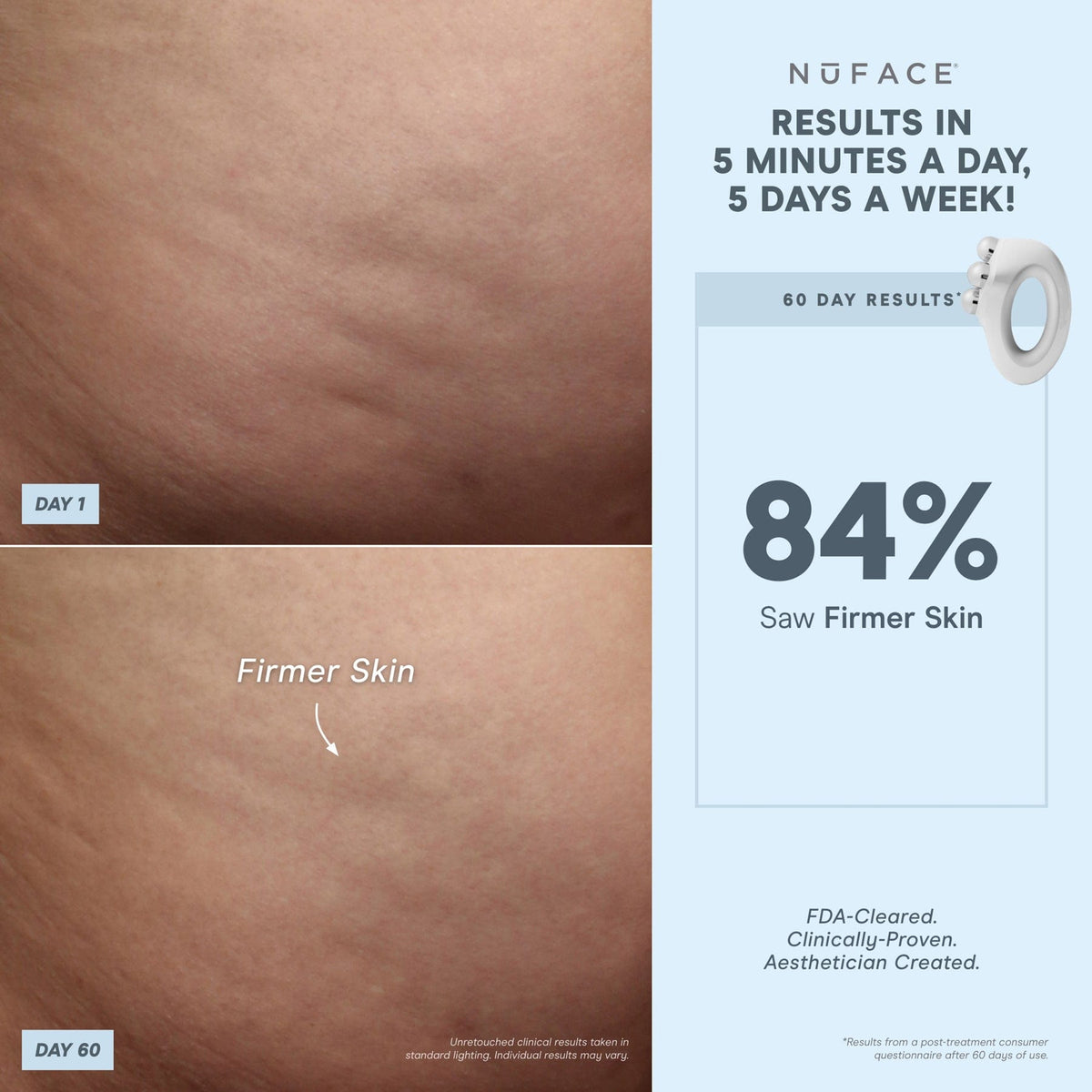 NuBODY® - Body Toning Device