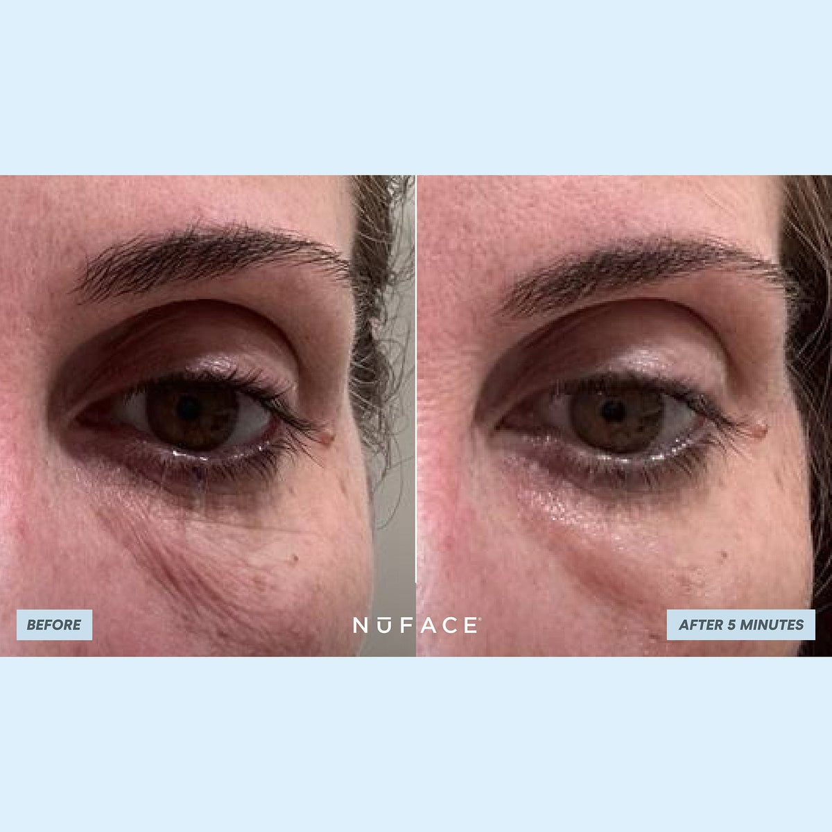 IonPlex® Hydra-Gel Power Patches - Eye Masks