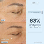 before and after infographic of nuface super booster