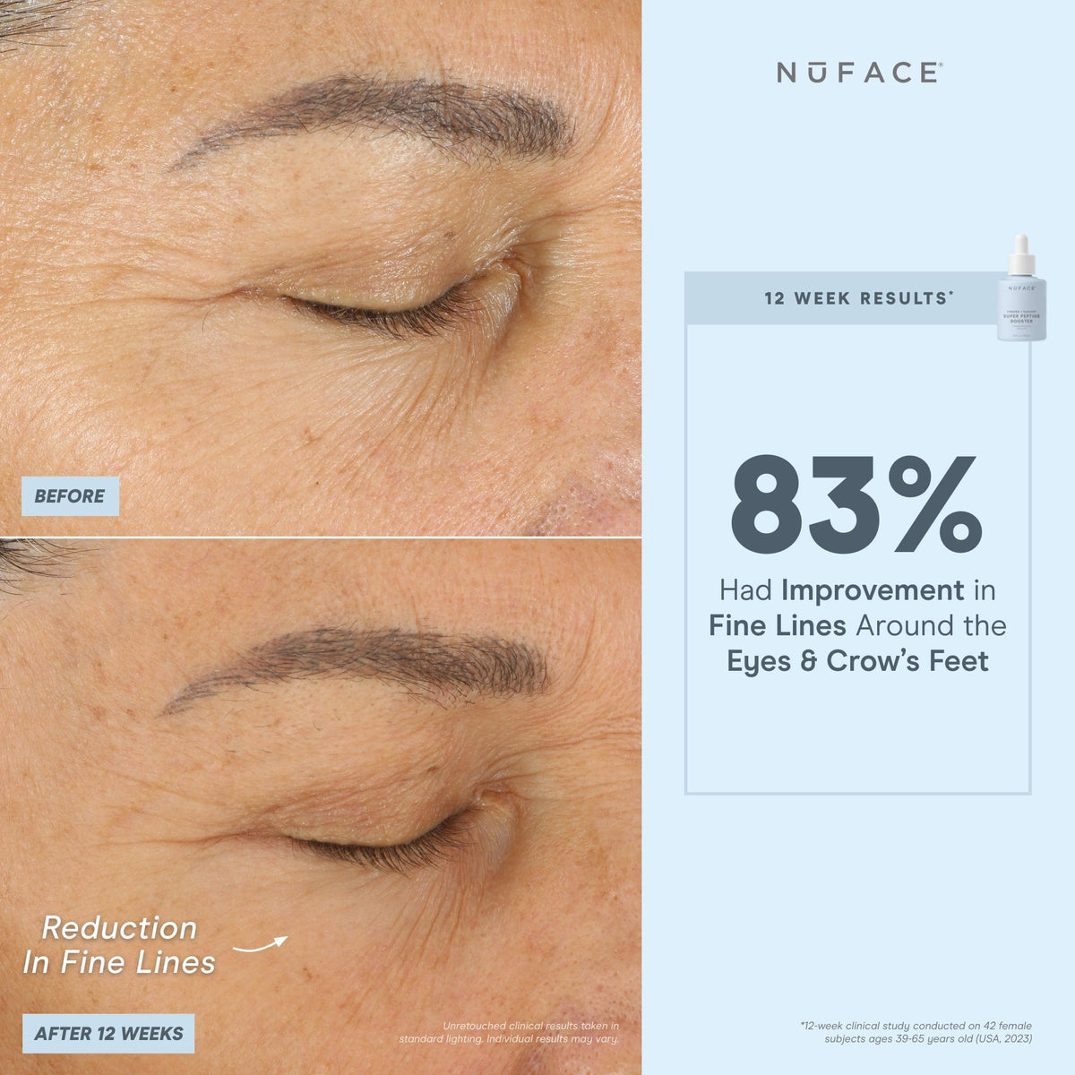before and after infographic of nuface super booster