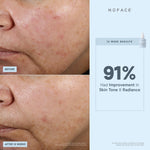 before and after infographic of nuface super booster