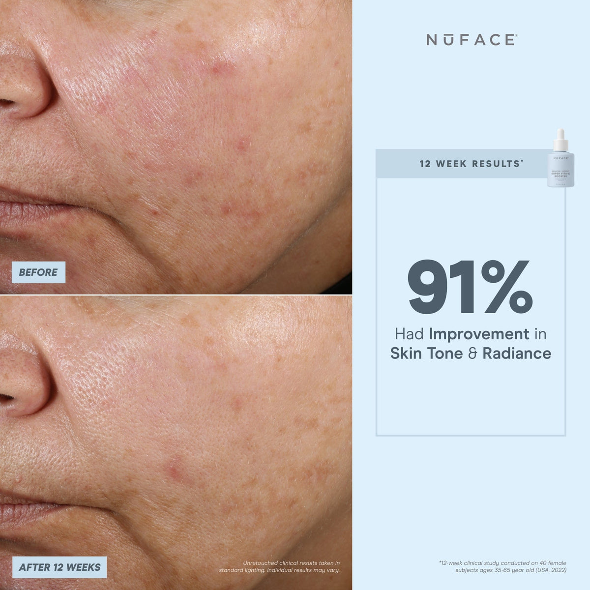before and after infographic of nuface super booster