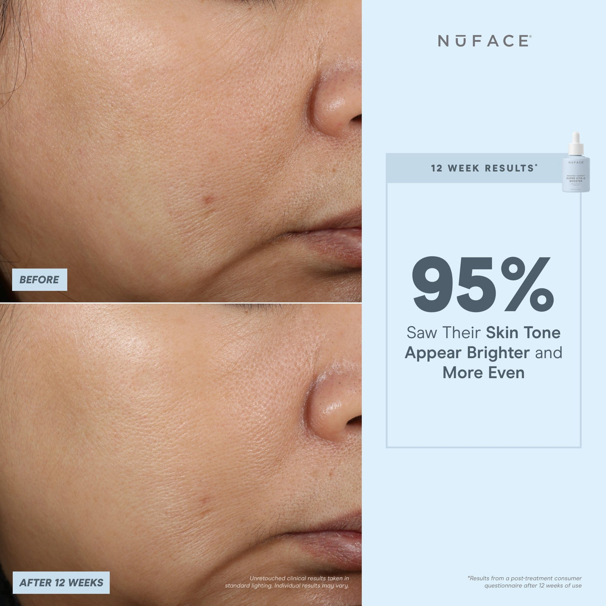 before and after infographic of nuface super booster