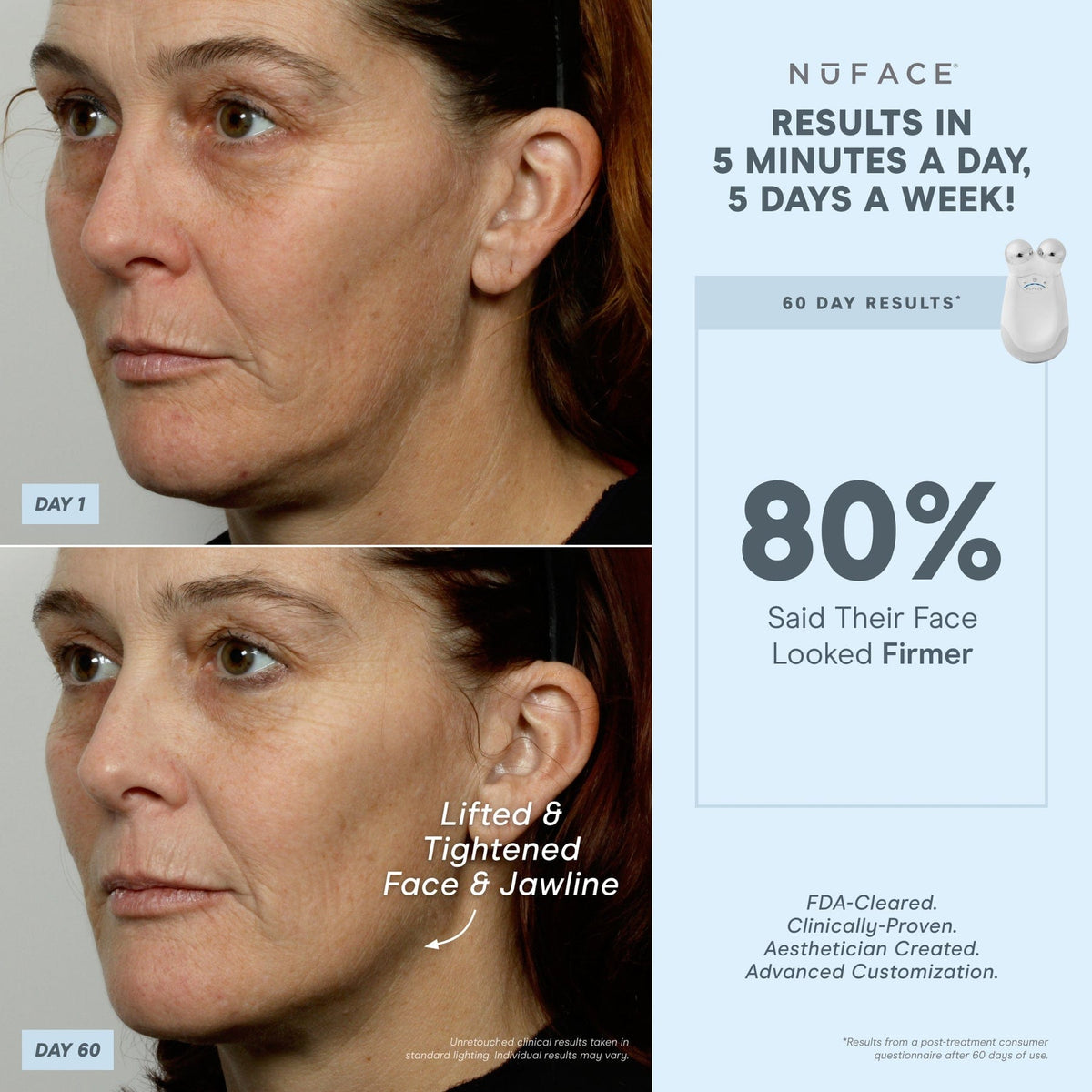 Refurbished NuFACE Trinity® and Effective Lip & Eye - Gift Set