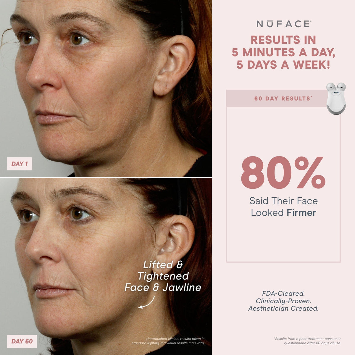 NuFACE® Mini Starter Kit - Mini Facial Toning Device