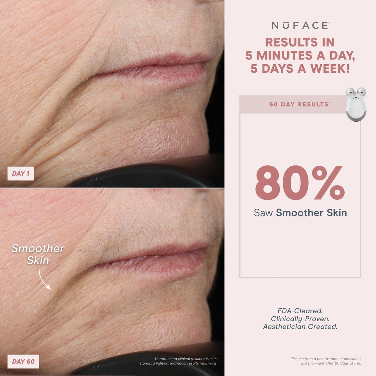 NuFACE® Mini Starter Kit - Mini Facial Toning Device