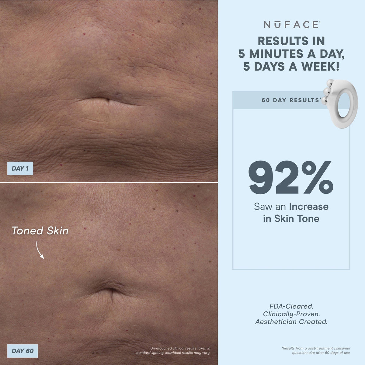 NuBODY® - Body Toning Device