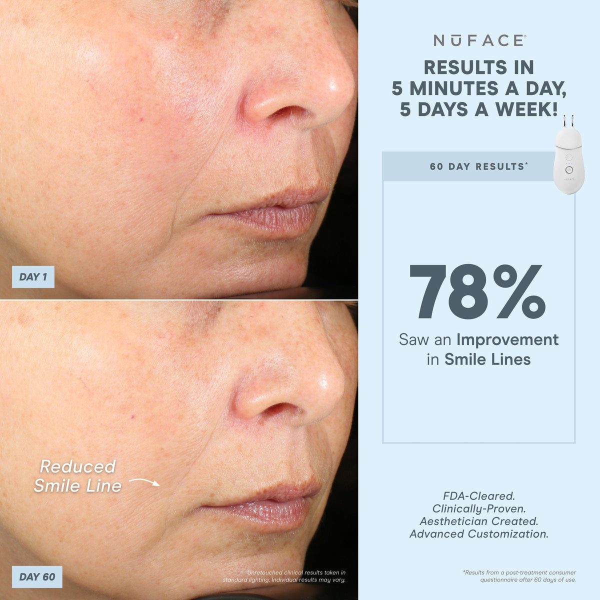 TRINITY+ and Effective Lip & Eye Attachment - Smart Advanced Facial Toning Device with Targeted Attachment