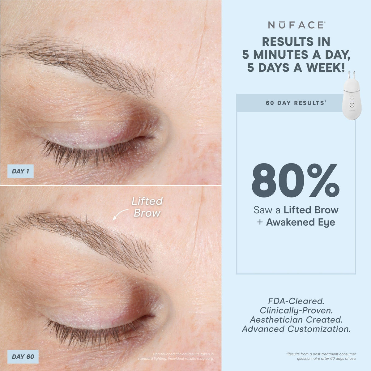 TRINITY+ and Effective Lip & Eye Attachment - Smart Advanced Facial Toning Device with Targeted Attachment