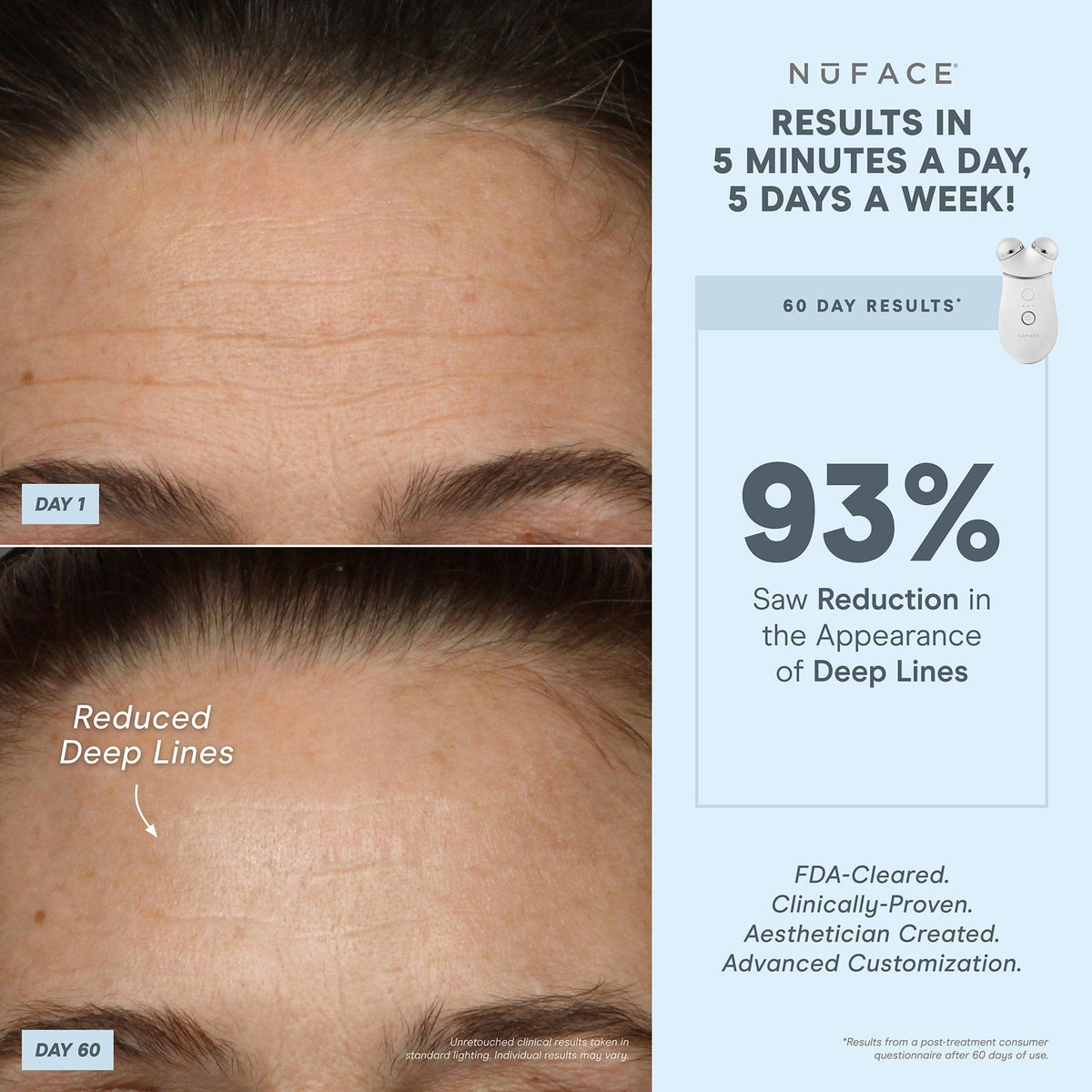 TRINITY+ and Effective Lip & Eye Attachment - Smart Advanced Facial Toning Device with Targeted Attachment