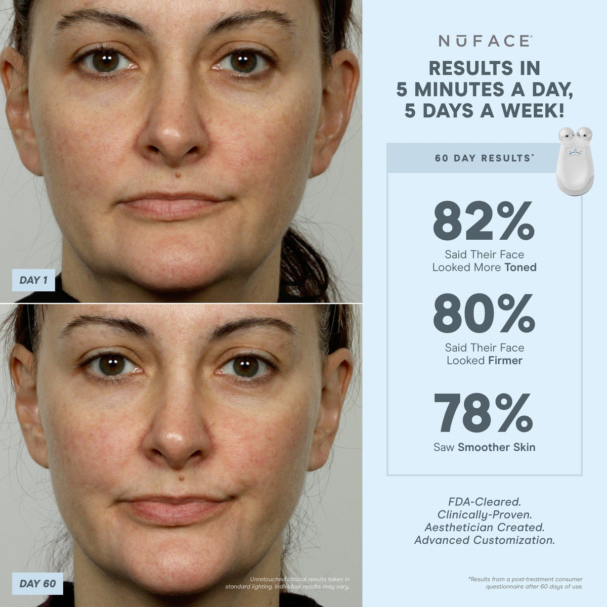 NuFACE Trinity® Starter Kit - Facial Toning Device